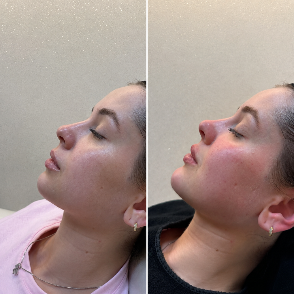 Registro de evolução facial real