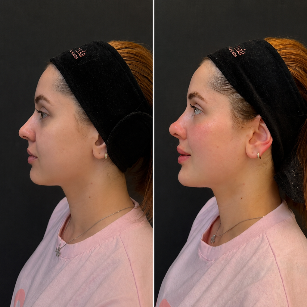 Registro real de antes e depois facial 8